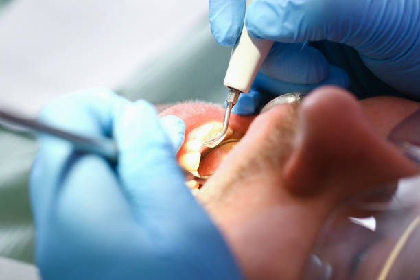 Best Orthodontic Emergency Dentist in Rutledge, GA