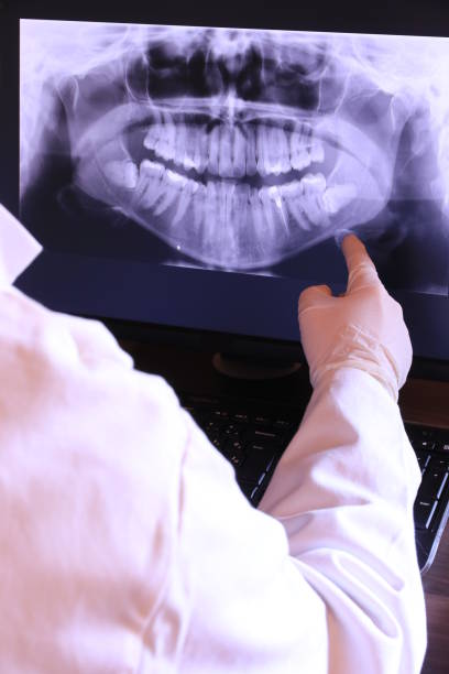Best Emergency Root Canal Treatment in Rutledge, GA