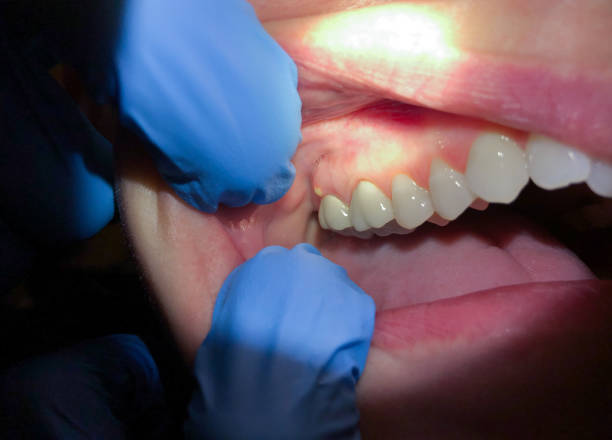 Best Emergency Dental Services for Seniors in Rutledge, GA